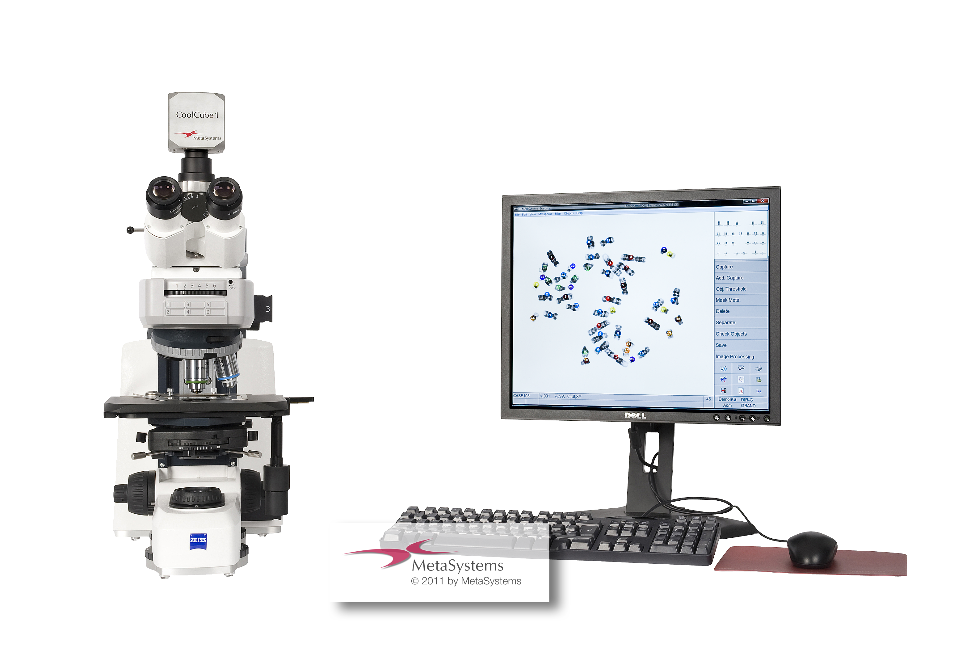 karyotyping