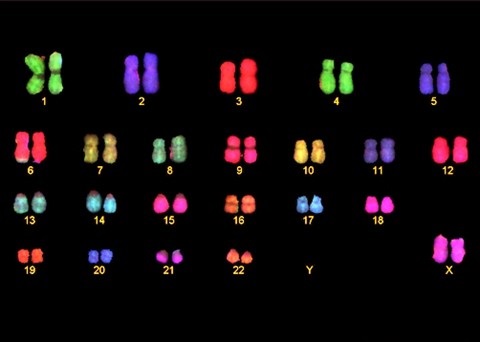 Metaphase_Fish