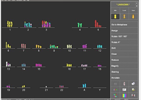 Automated_Karyotyping_System